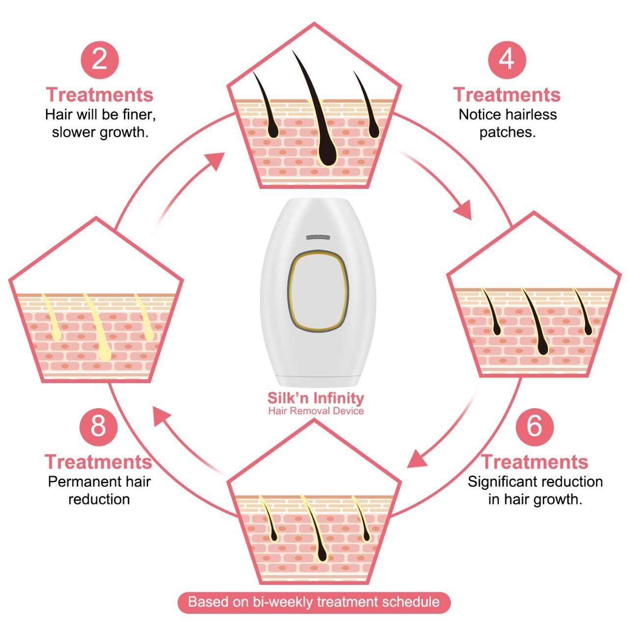 Laser Hair Removal Apparatus Digitalshoper