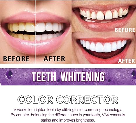 Toothpaste for Teeth Whitening (30ml) Digitalshoper