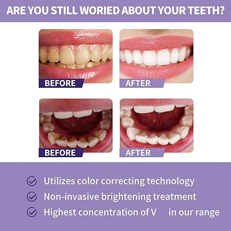 Toothpaste for Teeth Whitening (30ml) Digitalshoper